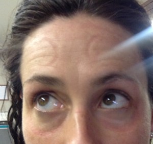 Google eyes: red irritated skin around the eyes after a 5k and on the forehead after resting the goggles there for only for av few minutes.